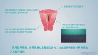 湖北大禹医疗器械有限责任公司招商信息与公司简介